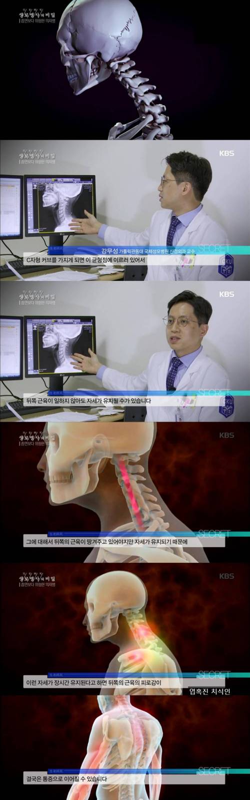 오래 앉아있는 현대인들이 피하지 못하는 질병...jpg