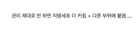 의사가 말하는 지방흡입술의 진실...jpg
