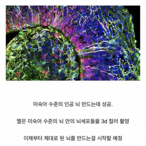 인공 장기 근황.jpg