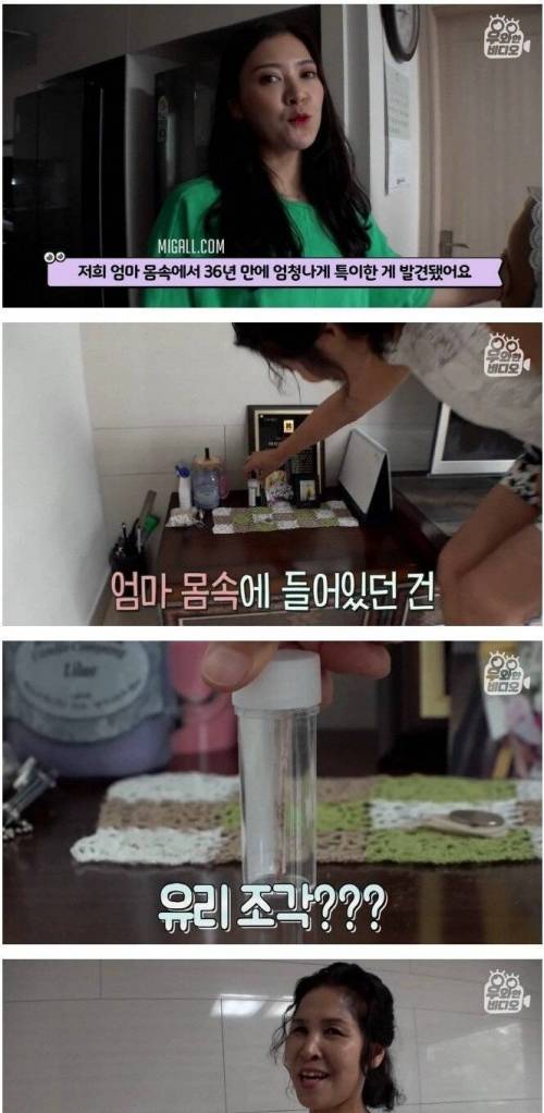 [스압] 36년 전 엉덩이에 박힌 유리조각.jpg