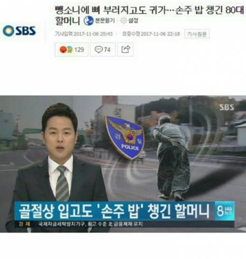 뺑소니에 뼈 부러지고도 귀가...jpg