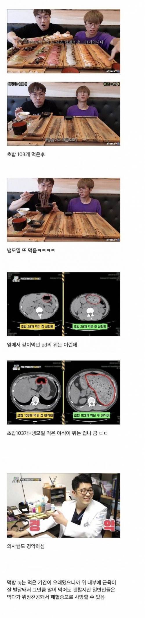 의사쌤도 경악한 먹방 bj 위상태.jpg