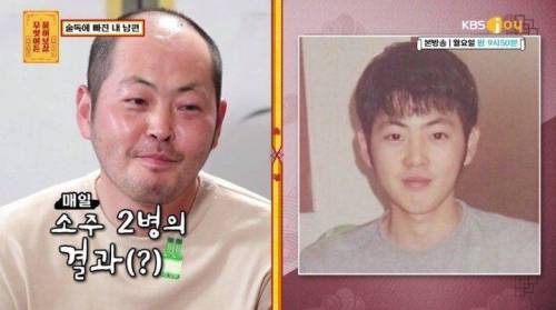 매일 소주 2병의 결과.jpg