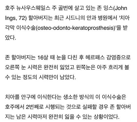 안구에 ‘치아’이식해 수술한 할아버지.jpg
