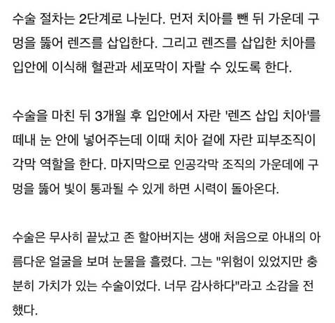 안구에 ‘치아’이식해 수술한 할아버지.jpg
