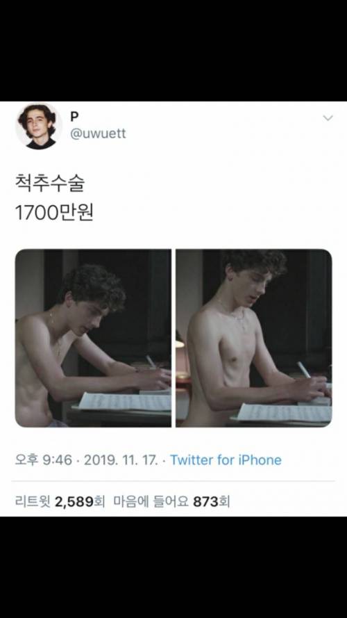 척추 수술 가격을 들었을 때
