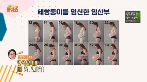 세 쌍둥이 임신.jpg