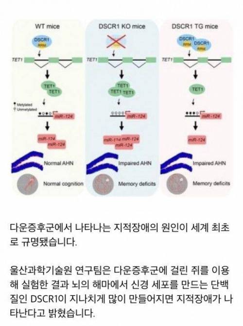 다운증후군 원인 규명 성공.jpg