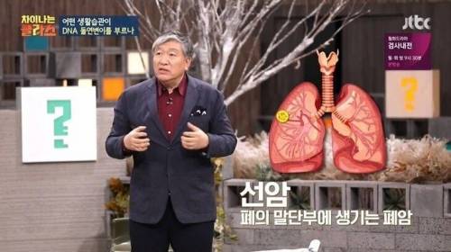 [스압] 담배 필터 개발 이후 폐암 발병.jpg