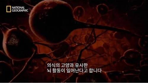 [스압] 노화와 퇴화 그리고 죽음.jpg