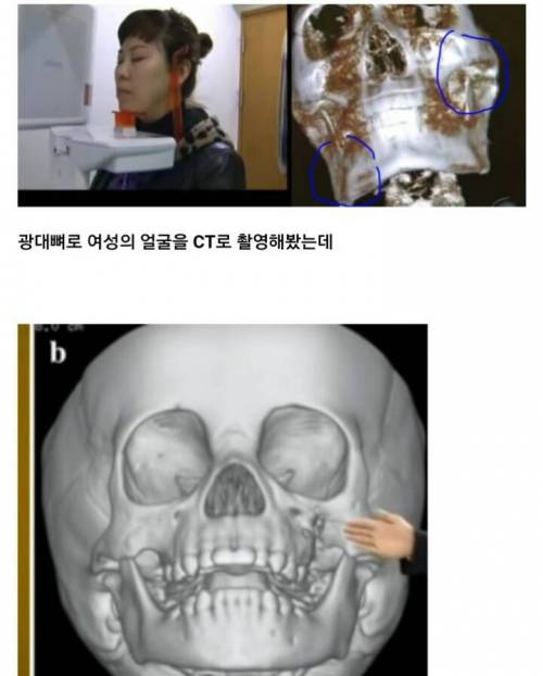 나이 먹으면 얼굴이 커지는 이유