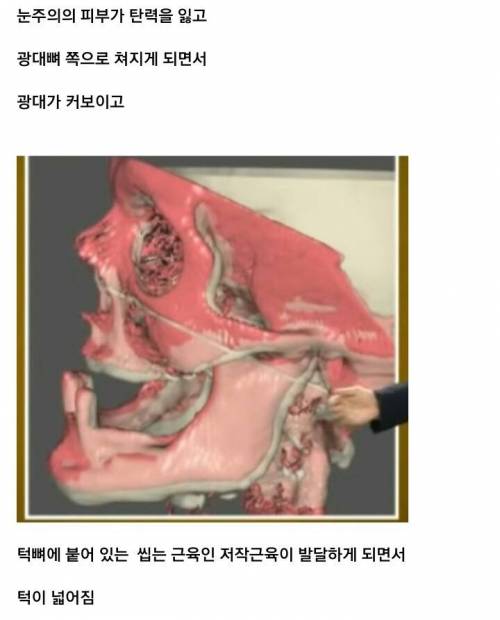 나이 먹으면 얼굴이 커지는 이유