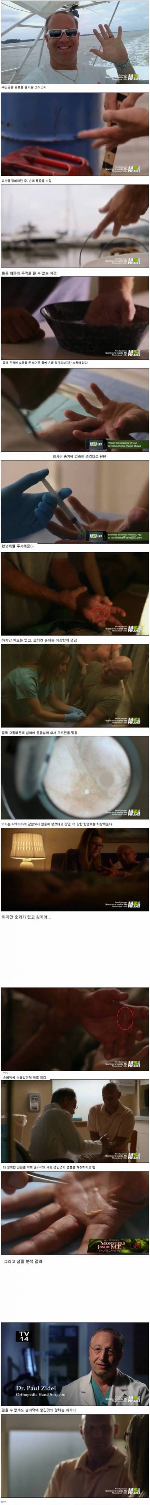 [스압] 사람 몸안에서 자라나는 그것.jpg