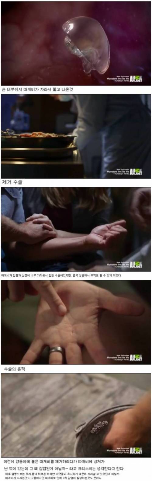 [스압] 사람 몸안에서 자라나는 그것.jpg
