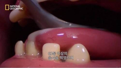 [스압] 노화와 퇴화 그리고 죽음.jpg