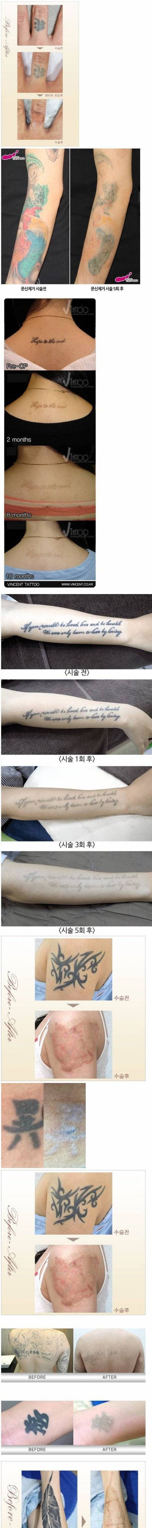 [스압] 문신을 하지 말아야 하는 이유