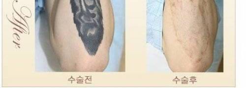 [스압] 문신을 하지 말아야 하는 이유