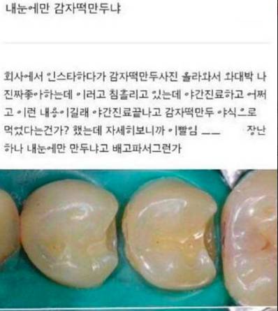 감자떡 만두.jpg