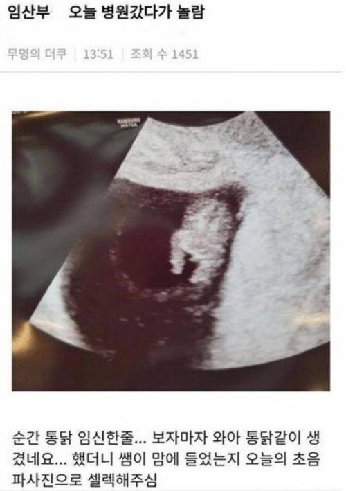 통닭을 임신한 여인.jpg