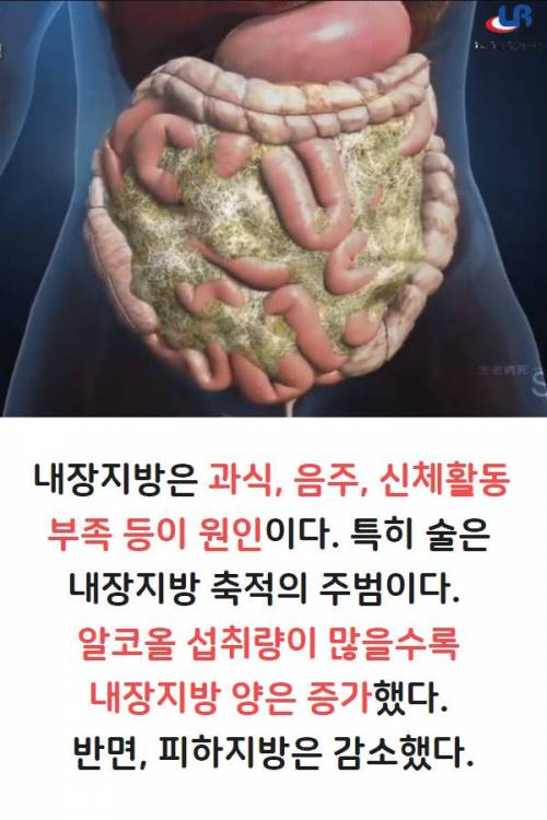 막연히 알고만있다가 실제로 보면 충격받는 내장지방 그림...jpg