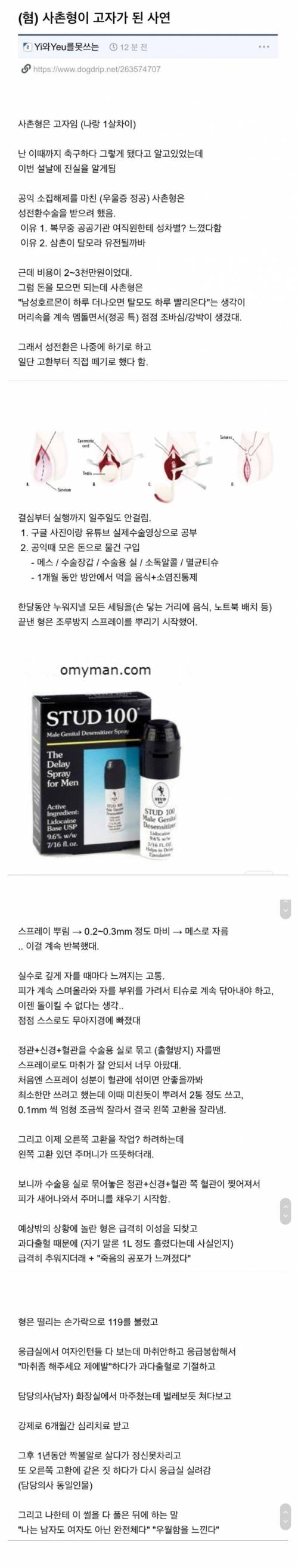 [글혐]사촌형이 고자가 된 사연