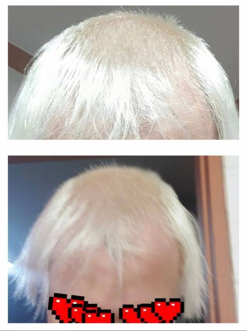 [스압] 산화제 많이 넣고 염색한 디씨인.jpg