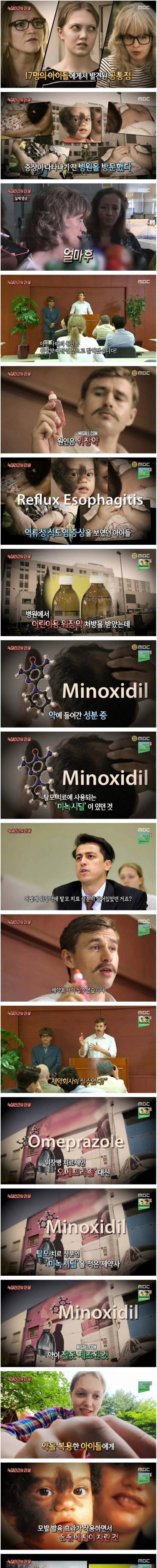 [스압] 스페인을 발칵 뒤집어놓은 늑대인간 소동.jpg