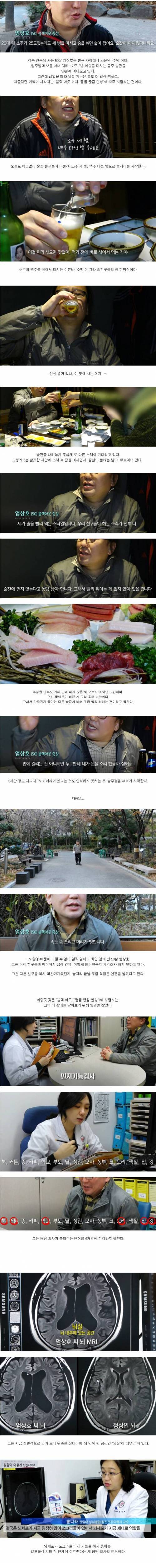 [스압] 술 마시면 자주 필름이 끊기는 50살 남성의 뇌 상태