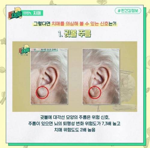 치매를 부르는 습관 jpg