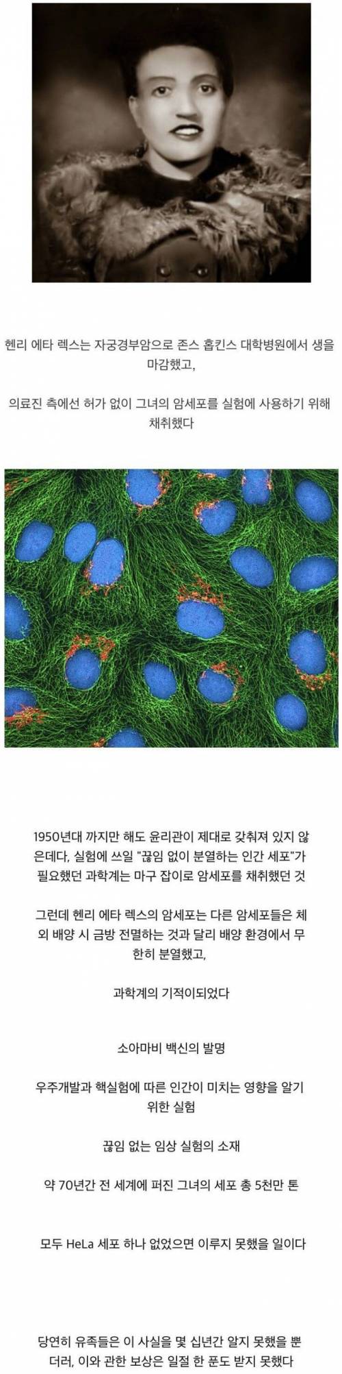 허술했던 연구 윤리 덕분에 70년 이상 살고 있는 세포.jpg