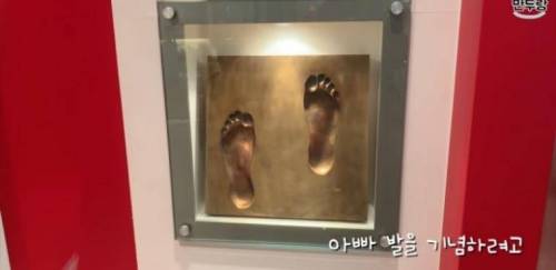 박지성 딸 : 아빠 발이 왜 이렇게 됐어?