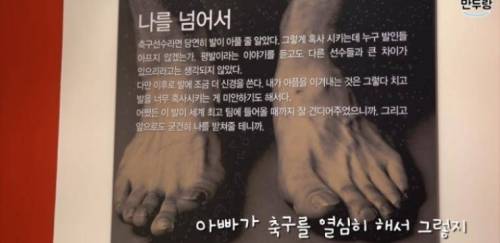 박지성 딸 : 아빠 발이 왜 이렇게 됐어?