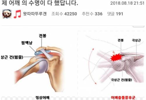 30대에 어깨 관절 끊어지기 직전이라는 한 네티즌