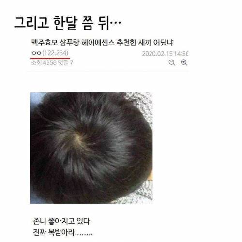 얼떨결에 풍성해진 탈모인 레전드