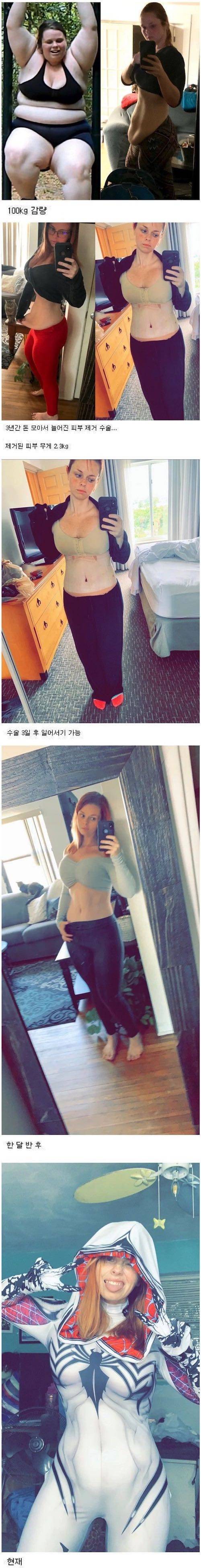 100kg 감량한 인간승리.jpg