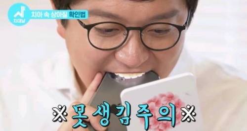 [스압] 치아 누렇게 되는 진짜이유.jpg