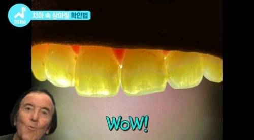 [스압] 치아 누렇게 되는 진짜이유.jpg
