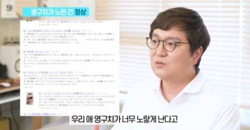 [스압] 치아 누렇게 되는 진짜이유.jpg