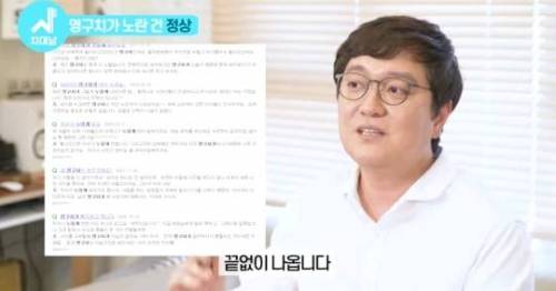 [스압] 치아 누렇게 되는 진짜이유.jpg