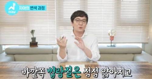 [스압] 치아 누렇게 되는 진짜이유.jpg