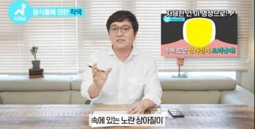 [스압] 치아 누렇게 되는 진짜이유.jpg