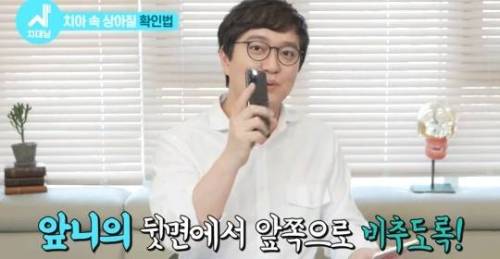 [스압] 치아 누렇게 되는 진짜이유.jpg