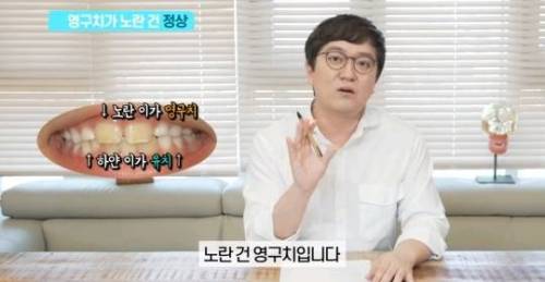 [스압] 치아 누렇게 되는 진짜이유.jpg