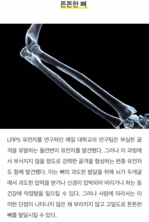 [스압] 희귀하고 독특한 신체특징 10가지.jpg