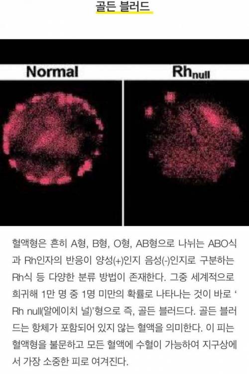 [스압] 희귀하고 독특한 신체특징 10가지.jpg