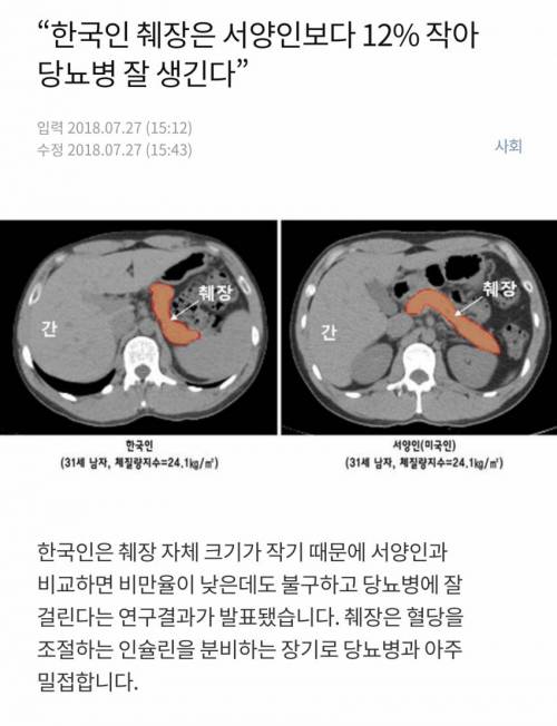 동양인이 특히 식습관에 주의해야하는 이유....jpg