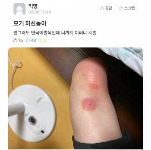 모기물린 곳 논란.jpg