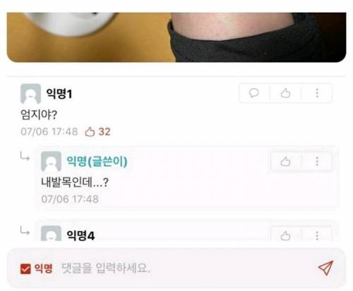 모기물린 곳 논란.jpg