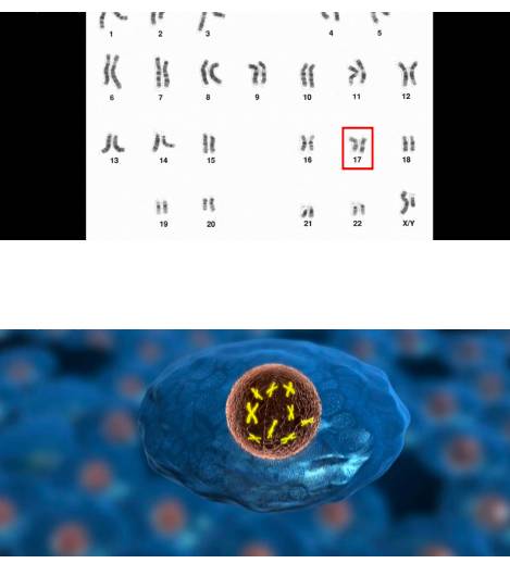 [스압] 치명적 가족력.jpg