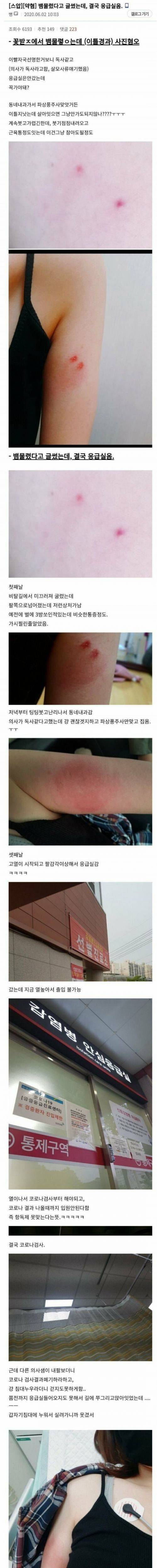 [스압] 뱀에 물린 후기.jpg